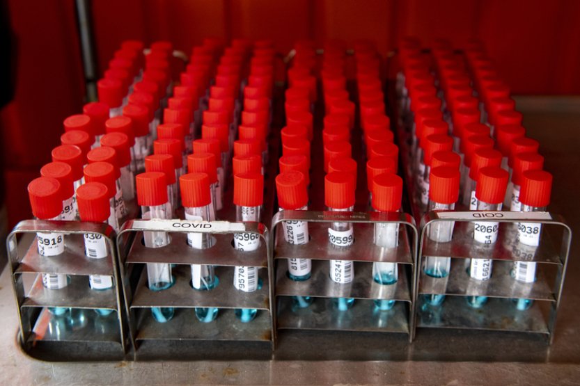 WP: Nejasnosti kolem dlouhého covidu přetrvávají