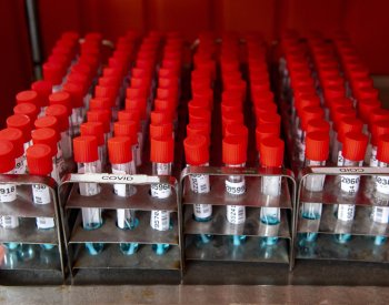 WP: Nejasnosti kolem dlouhého covidu přetrvávají