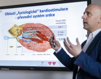 Nová metoda zavádění kardiostimulátorů je má víc přiblížit běžné činnosti srdce