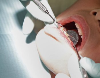 Zubaři: Stát by měl hradit plombu aspoň z 80 %, MZd navrhuje polovinu