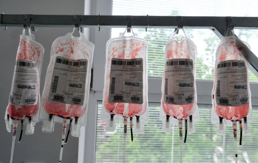 Kontaminovanou krví se v Británii nakazilo 30.000 lidí, každý desátý zemřel