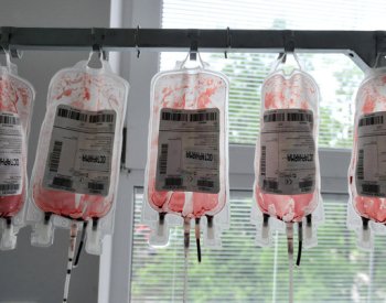 Kontaminovanou krví se v Británii nakazilo 30.000 lidí, každý desátý zemřel