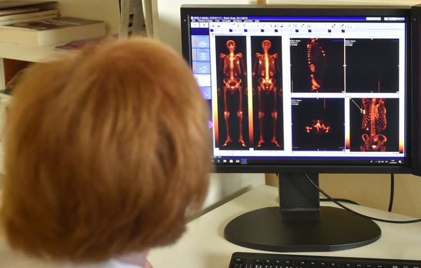 Výzkum: Počet případů rakoviny u osob mladších 50 let roste dvakrát rychleji