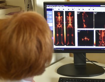 Výzkum: Počet případů rakoviny u osob mladších 50 let roste dvakrát rychleji