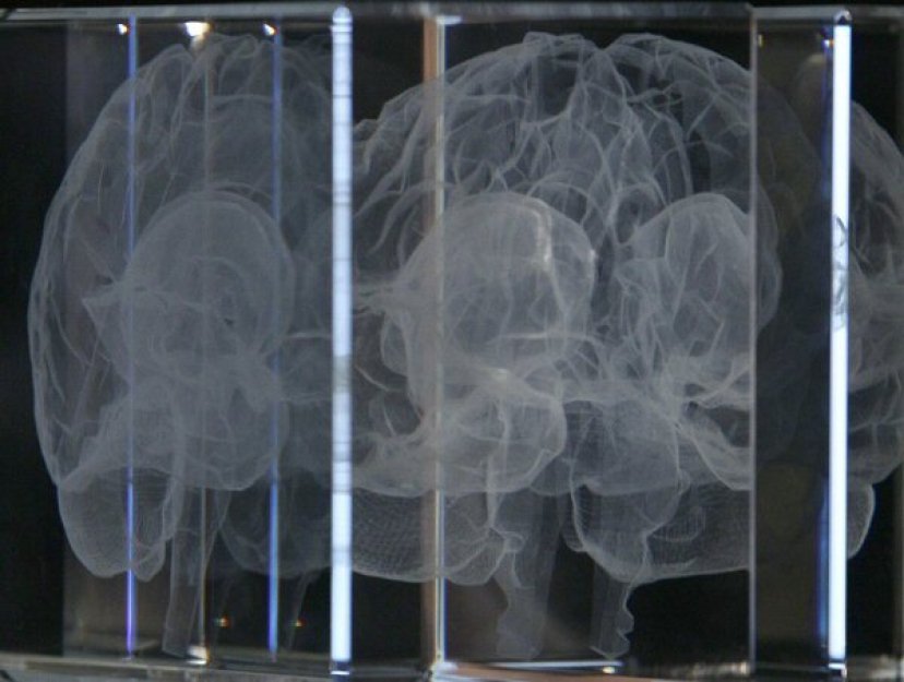 Elektrická stimulace mozku může zmírnit pocit zlomeného srdce, zjistila studie