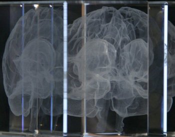 Elektrická stimulace mozku může zmírnit pocit zlomeného srdce, zjistila studie