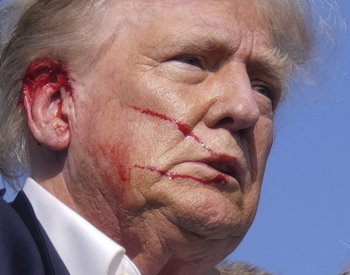 Trump přežil útok střelce na volebním mítinku, vyzval USA k jednotě