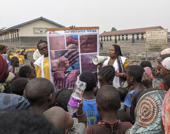 WHO vyhlásila nejvyšší stupeň varování kvůli virovému onemocnění mpox