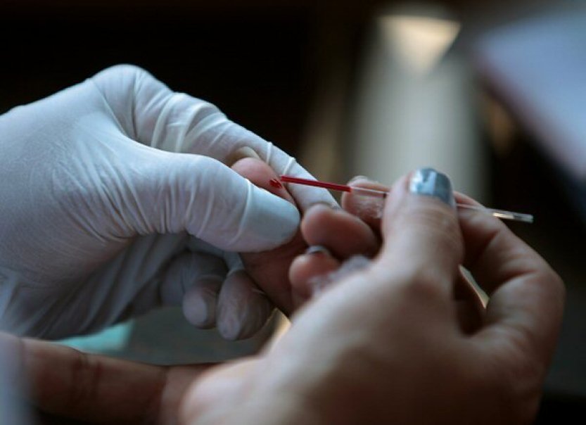 Nových případů HIV je více než před rokem, snížil se podíl cizinců