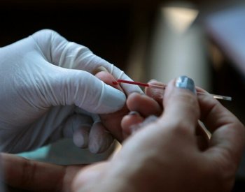 Nových případů HIV je více než před rokem, snížil se podíl cizinců