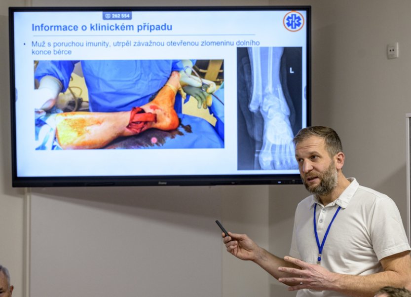 Lékaři v Ústí nad Labem pacientovi vložili 3D implantát na místo chybějící kosti
