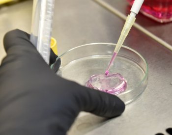 V mražených pelmeních v Písku byla salmonela, prodalo se jich téměř 500 kg