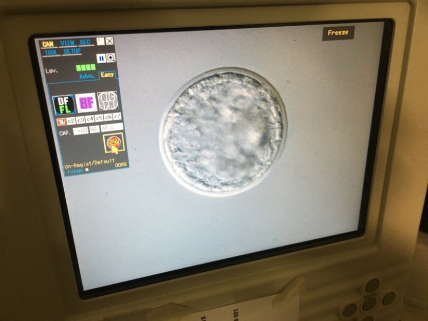 Vědci vytvořili prvotní zárodečné buňky z ohroženého nosorožce