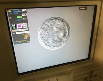 Vědci vytvořili prvotní zárodečné buňky z ohroženého nosorožce