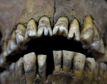 Dávní Evropané jedli mořské řasy a vodní rostliny, ukázal rozbor zubního kamene