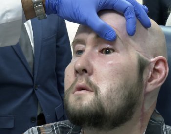 Američtí lékaři provedli první transplantaci životaschopné oční bulvy v historii