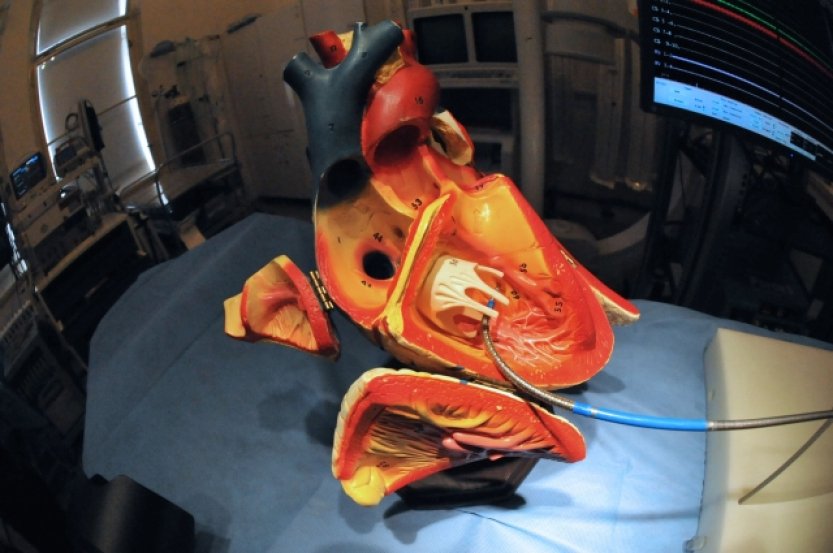 Blížící se srdeční kolaps pomůže rozpoznat srdeční implantát a nová aplikace