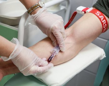 Krevní test na určení stáří orgánů by mohl pomoci předpovědět riziko onemocnění