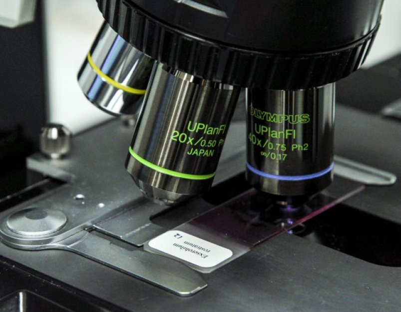 Vědcům se podařilo oživit hlístice 46.000 let zamrzlé v permafrostu